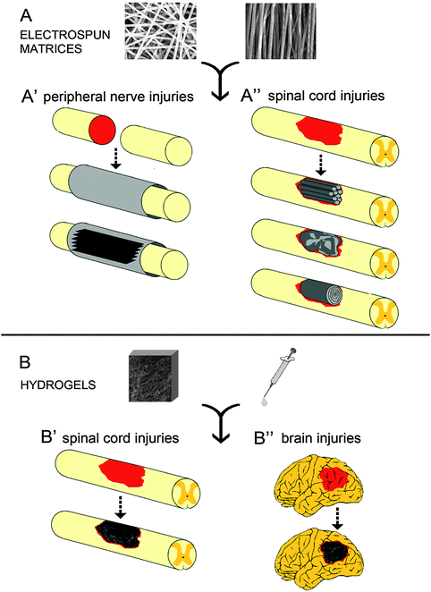 Electrospun fiber- and hydrogel-based scaffolds for neural tissue engineering. (A) Electrospun matrices, comprising either randomly or longitudinally oriented micro- and nanofibers, may have multiple layers featuring different fibers orientation. In peripheral nerve transections (A′) electrospun scaffolds serve as nerve conduits and/or as multiple films to be stacked into the nerve channel. On the other hand, electrospun scaffolds for spinal cord reconstruction (A′′) include multiple micro-channels or a single electrospun film that can be crumpled into the lesion area or rolled up to form a multilayered tubular construct. (B) Hydrogel-based scaffolds can be prepared as either preformed solid gel or viscous solution and, respectively, implanted or injected into the lesion site. Both strategies have been employed to fill cavities resulting from either spinal cord injuries (B′) or brain injuries (B′′), thus providing a nanostructured matrix for tissue regrowth.