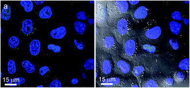 (a) Confocal picture of HeLa cells with stained nucleus (blue) incubated with 50 μg mL−1 TBA-{P2W17O61Fluo} (green) for 24 h; (b) confocal picture merged with the DIC image showing the intact cell morphology.