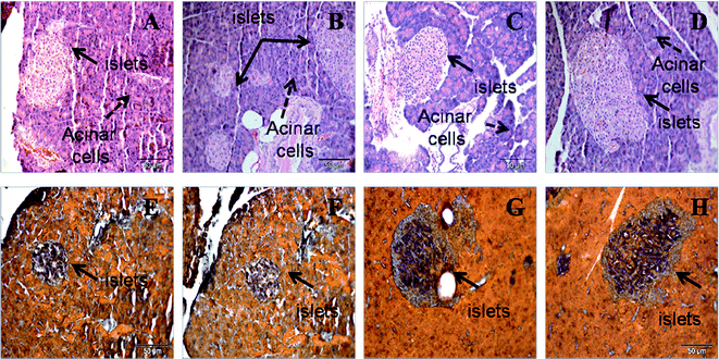 Haematoxylin and eosin staining (upper panel) of pancreas (×20) showing hypertrophied islets of Langerhans in H (B) rats compared to C (A) rats, with reduction in CA (C) and HA (D) rats. Aldehyde fuchsin stain (lower panel) for islets showing insulin-positive area as dark red inside the islets of Langerhans in H (F) rats compared to C (E) rats, with reduction in CA (G) and HA (H) rats. C, corn starch-rich diet-fed rats; CA, corn starch-rich diet-fed rats treated with l-arginine; H, high carbohydrate, high fat diet-fed rats; HA, high carbohydrate, high fat diet-fed rats treated with l-arginine.