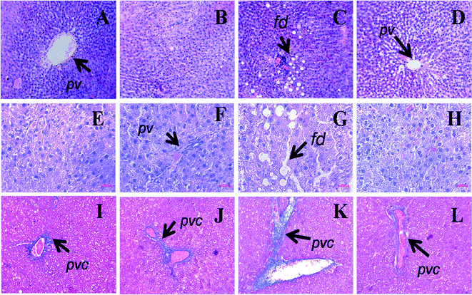 Haematoxylin and eosin staining of liver (×20) showing portal vein (pv), fat droplets (fd, arrow head) in C (A), CA (B), H (C) and HA (D) rats (upper panel). Middle panel shows higher magnification (40×) of liver section of C (E), CA (F), H (G) and HA (H) rats. Milligan's trichrome staining of the hepatic tissue (×20) showing collagen deposition as darker blue region in C (I), CA (J), H (K) and HA (L) rats (lower panel). pv – Portal vein, pvc – portal vein collagen, fd – fat droplet; C, corn starch-rich diet-fed rats; CA, corn starch-rich diet-fed rats treated with l-arginine; H, high carbohydrate, high fat diet-fed rats; HA, high carbohydrate, high fat diet-fed rats treated with l-arginine.