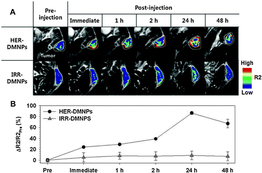 (A) Color-coded T2-weighted MR images of tumor-bearing mice after the intravenous injection of HER2/neu antibody (herceptin)-modified pH-sensitive drug-delivering magnetic nanoparticles (HER-DMNPs) and DMNPs modified with an irrelevant antibody (IRR-DMNPs) at various time intervals, respectively. Tumor regions are indicated with a white dashed boundary. (B) ΔR2/R2Pre graph versus time after the injection of HER-DMNPs (black circle) and IRR-DMNPs (gray triangle). Reproduced from Lim et al.93
