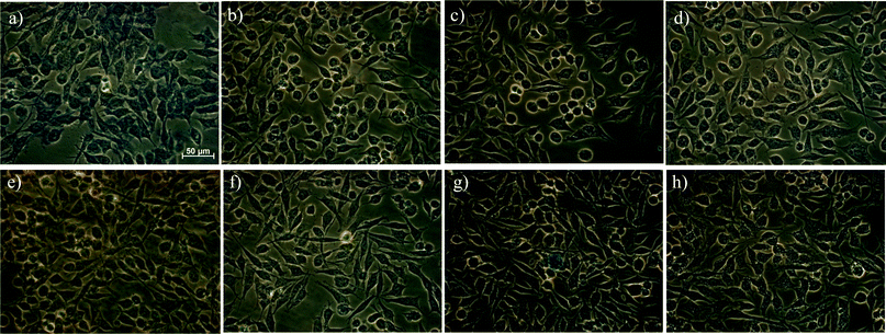 Iron uptake into HeLa cells determined using Prussian blue after 24 hours incubation: (a) FeCl3 (400 μg mL−1), (b) control, (c) Dex-NPs (400 μg mL−1), (d) Dex-NPs (40 μg mL−1), (e) ZDS-NPs (400 μg mL−1), (f) ZDS-NPs (40 μg mL−1), (g) TD/ZDS-NPs (400 μg mL−1), (h) TD/ZDS-NPs (40 μg mL−1).