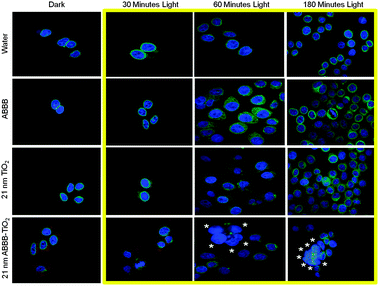 HeLa cells were exposed to water, ABBB, 21 nm TiO2 nanoparticles, or 21 nm ABBB–TiO2 nanoparticles and either no light or 750 W halogen visible light for 30, 60, or 180 minutes (yellow box). Cells were fixed in 4% formaldehyde 24 hours post exposure and 1 μm slices fluorescence confocal images are presented. Under this duration of light activation, no detectable cellular responses are visualized under any of the treatments exposed to dark or 30 minutes of visible light. Increased nuclear condensation, alterations in emerin integrity, and cellular aggregation (*) are visualized some cells exposed to ABBB–TiO2 nanoparticles and increased durations of visible light (60 and 180 minutes). The cellular response is heterogeneous. (Blue = Hoechst 33342/DNA; Green = Emerin; Red = ABBB–TiO2 nanoparticles).
