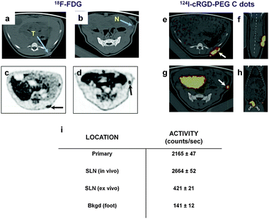 Image-guided SLN Mapping in a spontaneous melanoma miniswine model: Pre-operative PET imaging. (a, b) Axial CT images reveal a left pelvic soft tissue mass (a, blue arrow) and left flank SLN (b, blue arrow). (c, d) Axial 18F-FDG PET images show localized activity within the tumor (c, black arrow) and left flank SLN (d, black arrow) following i.v. tracer injection. (e) Axial and (f) coronal 124I-cRGDY-PEG-C dot co-registered PET-CT images show site of local injection about the pelvic lesion (e, white arrow). (g) Corresponding axial and (h) coronal co-registered PET-CT images localize activity to the SLN (g, white arrow). Large bladder uptake is also evident in both images. (i) Radioactivity levels of the primary tumor, SLN (in vivo, ex vivo), and a site remote from the primary tumor (i.e., background), using a handheld gamma probe.