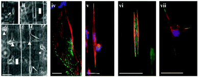 Optical images of cellular morphologies on SS: (i) spindle (indicated by an arrow), (ii) rectangular (indicated by a rectangle), and on SD nanofibers (iii) circular (indicated by *), spindle (indicated by an arrow), rectangular (indicated by a rectangle) and polygonal (indicated by triangles), immunostained images of DBTRG-05MG cells (iv) on flat, (v) spindle shaped on a single nanofiber, (vi) rectangular between two parallel nanofibers, and (vii) polygonal on an intersection of two orthogonal nanofibers. Stains: blue (DAPI, nucleus), red (Phalloidin, F-actin), and green (Alexa Fluor®, focal adhesion paxillin). Scale bar = 50 μm.