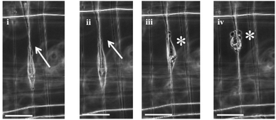 Time lapse of a single DBTRG-05MG migrating along a single nanofiber at 10 minute intervals. (i) and (ii) show the extension of leading edges (marked by arrows), and (iii) and (iv) show retraction of the trailing edge. Cell does not bleb when spread (i) and (ii), and starts blebbing (shown by *) once the spread area reduces, (iii) and (iv). Scale bar = 50 μm.