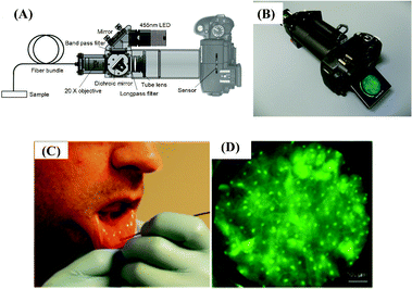 Schematic diagram (A) and picture (B) of the portable fiber-optic fluorescence imaging platform that uses a digital single-lens reflex (DSLR) camera introduced by Shin et al.124 (C) In vivo imaging of healthy human oral mucosa. (D) An image of human mucosa labeled by proflavine was acquired by the DSLR based micro-endoscope shown in (A) and (B). Reprinted from ref. 124 with permission from PLoS One.