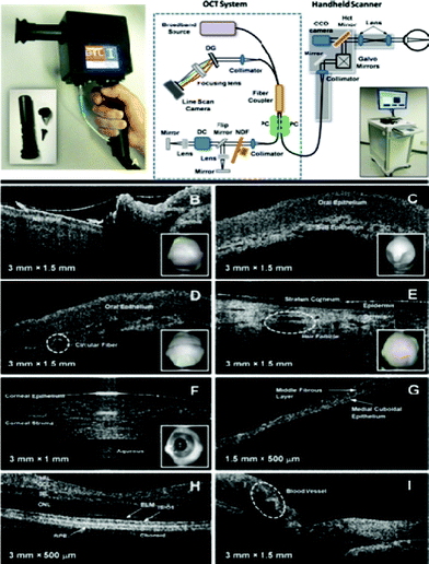 (Top panel) Shows a photograph of the handheld SD-OCT scanner unit (left) together with a schematic illustration of the entire OCT system (right). (Bottom panel) Shows in vivo cross-sectional images of normal human tissue obtained using this OCT system.147 Reprinted from ref. 147 with permission from IEEE Engineering in Medicine and Biology Society.