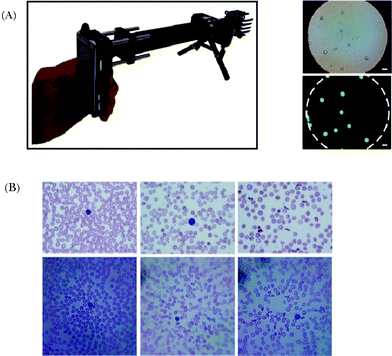 (A) (Left) Mobile phone microscope prototype,42 with LED and filters installed, capable of fluorescence imaging. (Right) The bright field and fluorescence imaging of 6 μm beads. (B) Micrographs of peripheral blood smears obtained by the cell phone microscope.46 Upper row: conventional microscope images. Bottom row: cell phone microscope images. Left column, images of normal blood sample. Center column, images of blood sample with iron deficiency anemia. Right column, images of blood sample with sickle cell anemia. Reprinted from ref. 42 and 46 with permission from PLoS One.