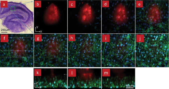 A fixed organotypic slice from an L15 transgenic mouse was perfused locally with a dextran for 12 min using a MFP. (a) Overview of a fixed and stained mouse organotypic hippocampal slice. The slice mounted on a coverslip was placed in a chamber with the coverslip serving as substrate to permit high resolution imaging using an inverted microscope. (b–j) Confocal images showing the dextran (red) distribution underneath the MFP and through the 70 μm thick slice. Micrographs are showing the XY images starting from 76 μm above the coverslip (b), down to 33 μm above the coverslip (j), with a 5.4 μm step size between each image. Blue (DAPI) and green (mGFP) colors represent the cell nuclei and membranes, respectively. No dextran is visible in (i,j), indicating that the maximal depth is less than 32 μm. (k–m) Confocal micrographs showing the different XZ cross-sections along the dashed lines shown in (f). These micrographs are showing the dextran confinement along the vertical plane. For reference, the top of the slice is indicated by the dashed line in (k). Reproduced by permission of The Royal Society of Chemistry.19