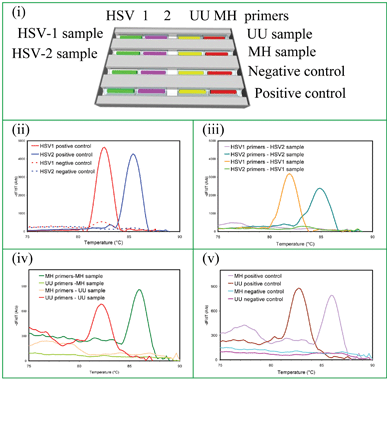 Simultaneous detection of 4 STIs in two different types of clinical sample (genital swabs and urine): (i) capillary arrangement for and sample types delivered to a wax cassette to detect HSV-1 and HSV-2 from genital swabs on the same cassette with UU and MH from urine. MCA data: (ii) positive and negative controls for HSV-1 and HSV-2, (iii) HSV-1 and HSV-2 sample detection, (iv) positive and negative controls for UU and MH, and (v) UU and MH sample detection. The melt temperatures of UU and MH are 82 °C and 86 °C, respectively.