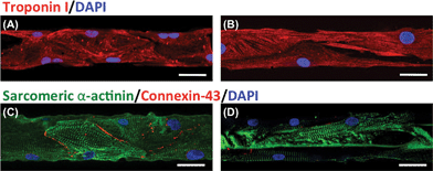 Confocal microscopy images showing immunostaining of CM markers inside microchannels coated with (A, C) 5% (w/v) MeTro and (B, D) 5% (w/v) GelMA on day 6 of culture. Hydrogels stained for (A, B) troponin (red)/nuclei (blue) and (C, D) sarcomeric α-actinin (green)/connexin-43 (red)/nuclei (blue) (scale bar = 50 μm).
