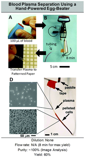 Plasma extraction using an egg-beater. (A) Approximately 100 μL of blood sample is collected in a polyethylene (PE) piece of tubing using a rubber bulb. Blood can also be drawn from a finger-prick. (B) The tubing is sealed at both ends and attached at the end of one paddle on the egg-beater. After 8 min of manual spinning at approximately 1200 rpm, the tubing is detached from the egg-beater and cut at the interface between plasma and supernatant. (C) The plasma is put in contact with the paper, which absorbs the plasma in the colorimetric cholesterol assay regions. (D) The purity was found to be close to 100% (50 000 cells remaining per mL). Adapted from ref. 208.