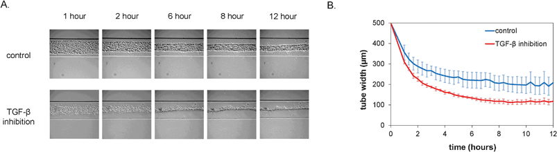 Formation of vascular structures within the first 12 h after seeding under control conditions and in the presence of inhibitory antibodies. A. Representative brightfield micrographs at different time-points after seeding. Channels are 500 μm wide. B. Quantification of tube width over time (n = 4, error bars denote standard deviation).