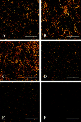 Collagen architecture modulated by polymerization conditions. Six ECM formulations were loaded into microfluidic channels as follows: (A) 2 mg mL−1 ColI + 2 mg mL−1 HA, no incubation, (B) 2 mg mL−1 ColI + 2 mg mL−1 HA, 1 h incubation at 4 °C before loading, (C) 3 mg mL−1 ColI + 2 mg mL−1 HA, no incubation, (D) 3 mg mL−1 ColI + 2 mg mL−1 HA, 1 h incubation at 4 °C before loading, (E) 4 mg mL−1 ColI + 2 mg mL−1 HA, no incubation, (F) 4 mg mL−1 ColI + 2 mg mL−1 HA, 1 h incubation at 4 °C before loading. Shown are representative z-stack projections of the SHG data obtained within the central culture channel. Scale bars represent 25 μm.