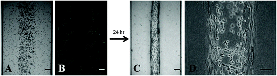 Establishment of the PDAC microenvironment culture. (A) Trilayer patterning of PSCs and PANC-1 cells suspended in an ECM composed of 2 mg mL−1 ColI + 2 mg mL−1 HA immediately after loading and polymerization within the device. All cells display a rounded morphology. (B) PSCs were dyed with CellTracker Green to demonstrate the ability to spatially pattern separate layers of PSCs and PANC-1 cells without the need for artificial barriers. (C) Contracted trilayer culture 24 h after loading. (D) Two dense PSC layers flank a central PANC-1 layer. Scale bars represent 100 μm.