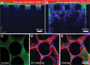 Representative images of media flow (containing tracking particles) through the capillary gel bed over 7 days of culture (A, B). The flow improved over time due to the presence of angiogenic sprouts. The lumen of the formed capillaries is shown in C–E. Figure reprinted with permission from Chan et al.3