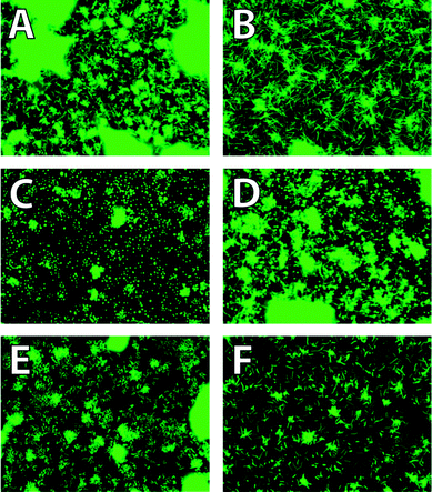 Fluorescence images displaying unique phenotypes with treatment of sub-lethal doses of antibiotics against V. cholerae (A) DMSO negative control, (B) ‘filament’, 12 nM ciprofloxacin (C) ‘spheroplast’, 2 mM ceftazidime, (D) ‘spherorod’, 25 μM ceftazidime, (E) ‘cobblestone or raspberry’, 0.8 μM tetracycline, (F) ‘ovoid’, 0.1 μM ciprofloxacin.