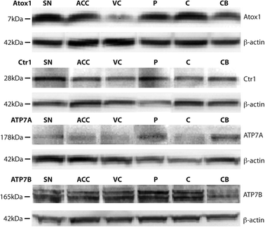 Representative Western blots demonstrating the presence of the major copper transport proteins Copper transporter 1 (Ctr1), Atox1, ATP7A, and ATP7B in multiple regions in the human brain, including the substantia nigra (SN), anterior cingulate cortex (ACC), visual cortex (VC), putamen (P), body of caudate (C), and cerebellum (CB). β-actin was used as a protein loading control.