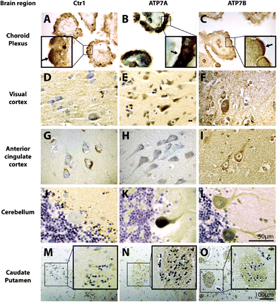 The cellular localization of copper transport proteins Copper transporter 1 (Ctr1), ATP7A, and ATP7B in the human brain. 7 μm paraffin embedded human brain sections were probed for copper transporters, Ctr1, ATP7A, and ATP7B using peroxidase immunohistochemistry (brown) with cresyl violet counterstain. Regions of positive staining are dark brown. Scale bar in L applies to A-L. Scale bar in O applies to M-O. Insets show localization of copper transport proteins in the choroid plexus and caudate putamen at higher magnification. Arrows in A-C insets highlight more concentrated positive staining on the apical (A and C) and basolateral (B) membranes.