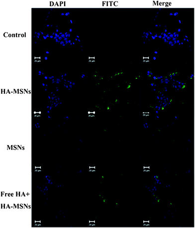 Confocal microscopy images of HCT-116 cells without any treatment as a control (first row), with the treatment FITC labelled HA-MSNs (second row), MSNs (third row) and free HA (10 mg mL−1) together with FITC labelled HA-MSNs (last row). Green fluorescence arises from FITC dyes that are conjugated to silica nanoparticles and nuclei are stained with DAPI, showing blue fluorescence.