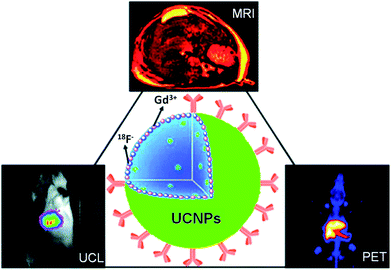 A scheme showing the use of 18F-labeled Gd-containing UCNPs for in vivo multimodal UCL, PET and MR imaging. Copyright 2011, American Chemical Society.30