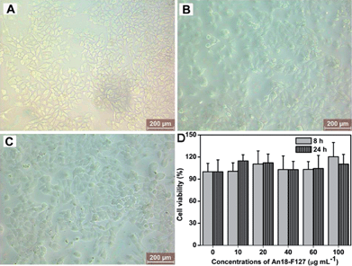 Biocompatibility of An18–F127. Optical microscopy of cells incubated with different concentrations of An18–F127 nanoparticles, (A) control cells, (B) 20 μg mL−1, (C) 100 μg mL−1, (D) time- and concentration-dependent cytotoxicity of An18–F127.