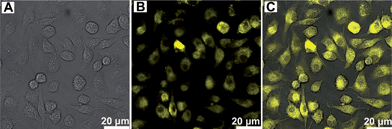 Cell imaging of An18–F127 nanoparticles using CSLM (A) bright field, (B) 405 nm excitations, (C) overlay of image A and B.