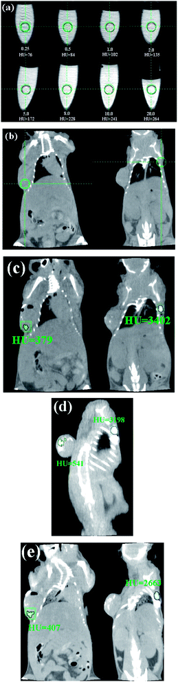 
          In vitro CT imaging of NaGdF4:Yb3+/Er3+ submicrocrystals suspended in PBS solution (a), in vivo CT imaging of mouse before injection (b), after injection (c), after 2 h injection (d) and after 4 h injection (e). As for the investigated nude mice, tumor sites are located in the left side of back, and normal tissues are located in the right side of back. Nude mice loaded with gastric cancer MGC803 cells was selected as the animal model. The tumor was implanted and grown in nude mice to an appropriate size (3–5 mm in diameter).