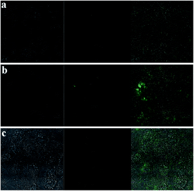 Upconversion luminescence imaging of GES-1 cells after incubation with different concentration of NaGdF4:Yb3+/Tm3+ submicrocrystals after 1 day (a) 20 μg mL−1, (b) 50 μg mL−1 and (c) 100 μg mL−1. Left image, bright field; middle image, luminescent image; right image, overlay image.
