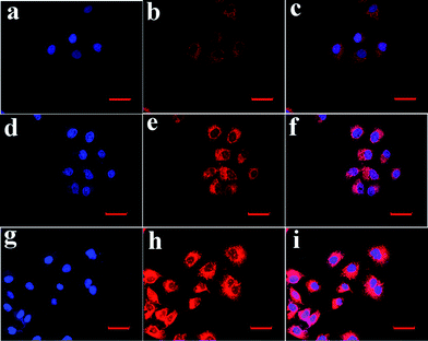 CLSM images of HeLa cells incubated with DOX-loaded PAA@GdVO4:Yb3+/Er3+ sample ([DOX] = 20 μg mL−1) for 10 min (a–c), 1 h (d–f), 6 h (g–i) at 37 °C. Each series can be classified to the nuclei of cells (being dyed in blue by Hoechst 33324 for visualization), DOX-loaded PAA@GdVO4:Yb3+/Er3+ sample, and a merge of the two channels of both above, respectively. All scale bars are 40 μm. The excitation wavelength of Hoechst 33324 and DOX are 405 and 543 nm, respectively. The red emission (572 nm) is from DOX.
