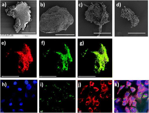 SEM images of (a) a SKOV-3 spheroid treated with DOX-HA-SNP (equivalent to 3.5 μM of DOX) for 72 h showing disintegration of the spheroid; SKOV-3 spheroids treated with (b) DOX or (c and d) DOX-HA-NP at [DOX] = 20 μM. The DOX-HA-NP caused a major reduction in the size and profound deformation of the spheroids, while free DOX did not have a significant effect on spheroids at the concentrations tested. Confocal images of the spheroid shown in (a): (e) DOX channel, (f) FITC channel, and (g) is an overlay of (e) and (f). The scale bars in (a–g) are 200 μm. (h–k) Confocal images of SKOV-3 cells upon incubation with DOX-HA-SNP. (h) DAPI channel showing positions of the nuclei; (i) FITC channel showing NP locations; (j) DOX channel showing location of DOX; and (k) overlay of images in (h–j) and the DIC images. The scale bars in (h–k) are 10 μm.