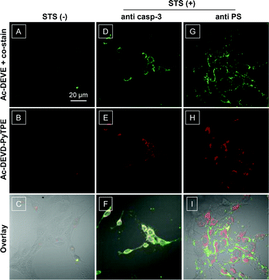 Confocal laser scanning microscopy (CLSM) images of live MCF-7 cell apoptosis. Normal (A, B) and apoptotic MCF-7 cells upon treatment with Ac-DEVD-PyTPE (5 μM, 1% DMSO) and co-stain with commercial antibody (D, E) or Annexin V-Alexa Fluor (G, H). STS (3 μM) was used to induce cell apoptosis for 2 h. Red = probe fluorescence (excitation at 405 nm using optical filters with band passes of 575–635 nm for images); green = fluorescence signal generated from anti-caspase-3 primary antibody and a FITC labelled secondary antibody or Annexin V-Alexa Fluor (excitation at 488 nm using optical filters >505 nm for images). The overlay images for AB, DE, and GH are shown in C, F and I, respectively. All images share the same scale bar of 20 μm.