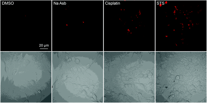 CLSM images of Ac-DEVD-PyTPE pre-incubated MCF-7 cells upon treatment with 3 μM each of DMSO, sodium ascorbate (Na Asb), cisplatin, and staurosporine (STS). [Ac-DEVD-PyTPE] = 3 μM. All images were acquired under the same condition.