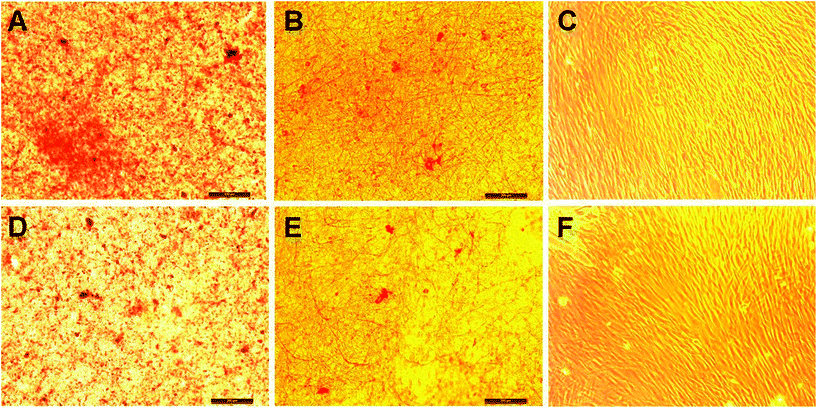 Collagen staining on fibroblasts on nanofibrous scaffolds: (A) PCL/P3HT(10) (S), (B) PCL (S), (C) TCP (S), (D) PCL/P3HT(10) (NS), (E) PCL (NS) and (F) TCP (NS).