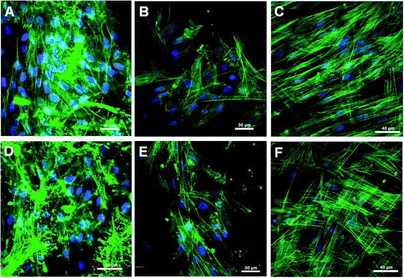 Laser scanning confocal microscopic (LSCM) micrographs of HDFs grown on (A) PCL/P3HT(10) (S), (B) PCL (S), (C) TCP (S), (D) PCL/P3HT(10) (NS), (E) PCL (NS) and (F) TCP (NS), expressing F-actin.