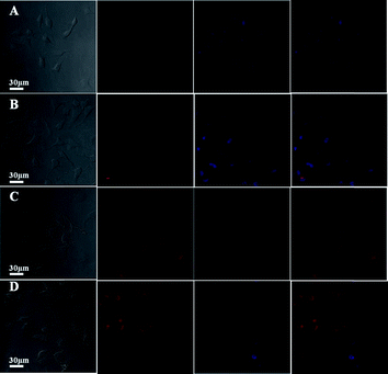 CLSM images of HeLa cells incubated with DOX-loaded H40-star-PCL-A:U-PEG micelles for (A) 15 min, (B) 1 h and (C) 6 h, and (D) free DOX for 15 min. Cell nuclei were stained with Hoechst 33342.