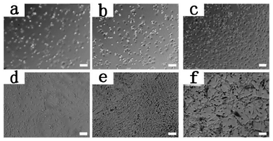 Phase contrast images of adhered SCCs on control (a, d), Gel-1 (b, e) and Gel-2 (c, f). Incubation time: a, b, and c, 2 h; d, e, and f, 3 days. Scale bar is 100 μm.