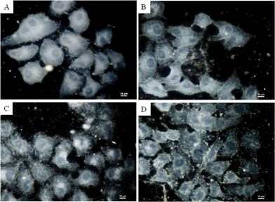 Optical images of HepG2 cells untreated (A) and treated with mint extracts (B), coffee extracts (C) and ginger extracts (D). Concentration of extracts = 20 μg mL−1.