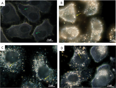 Optical images of HepG2 cells untreated (A) and treated with Ag–mint (B), Ag–coffee (C) and Ag–ginger (D) NPs. Concentration of Ag NPs = 20 μg mL−1. Green arrows point to cellular components such as endosomes and lysosomes, while yellow arrows point to big Ag NPs aggregates.