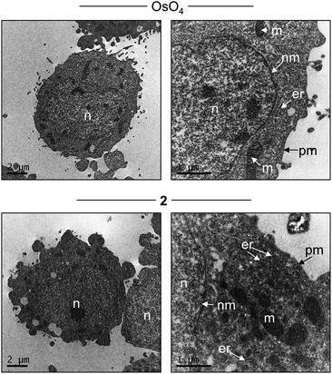 TEM of HeLa cells stained with either OsO4 (top) or 2 (bottom). Labelling: n = nucleus, nm = nuclear membrane, er = endoplasmic reticulum, m = mitochondria, pm = plasma membrane.
