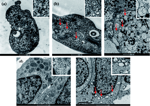 TEM images of the Trypanosoma brucei parasites and mammalian U2OS cells. (a) T.b. parasite without microspheres, the enlarged image of parasite tissue is shown in the inset; (b) Trypanosoma brucei parasite with penetrated microspheres, the enlarged image of parasite tissue with penetrated iron oxide coated PMs is shown in the inset; (c) a large Trypanosoma brucei parasite with penetrated microspheres, the enlarged image of parasite tissue with penetrated iron oxide coated PMs is shown in the inset; (d) mammalian U2OS cells without microspheres, the enlarged image of cell tissue is shown in the inset; and (e) mammalian U2OS cells with penetrated microspheres, the enlarged image of cell tissue with penetrated iron oxide coated PMs is shown in the inset. Some of the spheres inside the parasites and cancer cells are marked with red arrows. The EDS analysis results are shown in Fig. S4 in the ESI.