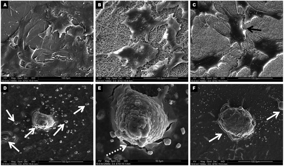 FESEM micrographs showing hMSCs-derived hepatocyte-like cells at day 28 on TCP (A), PLACL (B) and collagen (C) as well as hepatospheres of different dimensions on PLACL/collagen nanofibrous scaffolds (D) at 1000× magnification. Representative micrographs showing hepatospheres formed on PLACL/collagen nanofibrous scaffolds are of different size, approximately 50 μm (E) to ∼95 μm diameter (F) at 2500× and 1000× magnification respectively. hMSCs adapted better on PLACL/collagen nanofibrous scaffolds for hepatic trans-differentiation to form hepatospheres. The white arrows in (D and F) represents hepatospheres of different diameters, whereas the white dotted arrow in (E) indicates the excessive ECM proteins secreted by hepatospheres spread over nanofibers. The black arrow in (C) indicates hepatocyte-like cells formed on the collagen nanofibrous scaffolds.