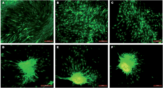 CMFDA fluorescent dye expression in trans-differentiating hMSCs on PLACL/collagen nanofibrous scaffolds depicting phenotypic progress in hepatosphere formation. Fluorescent micrographs show an undifferentiated fibroblastic morphology on day 7 (A), a cuboidal morphology on day 14 (B) and day 18 (C), cell migration on day 21 (D), aggregate formation on day 24 (E) and mature hepatosphere formation on day 28 (F) (scale bar = 200 μm).