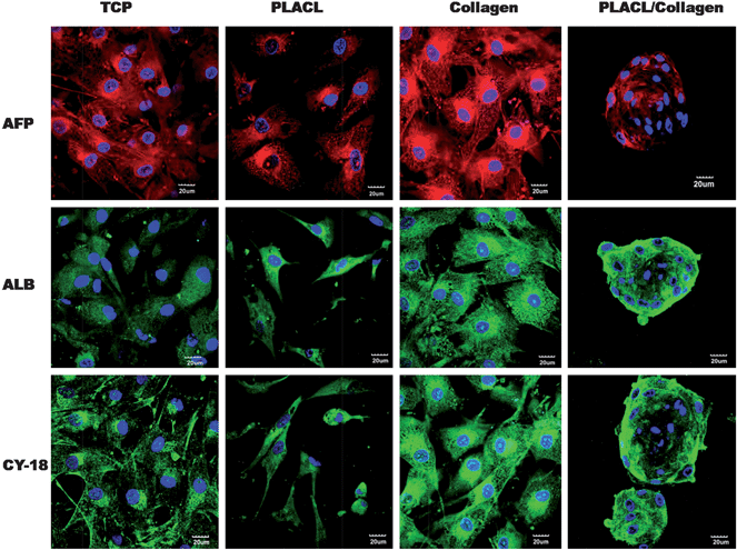 Confocal microscopy images (merged) showing expression of hepatocyte specific markers, AFP (Alexa fluor 594: red colour), ALB (Alexa fluor 488: green colour) and CY-18 (FITC: green colour) for hepatocyte-like cells formed on TCP, PLACL and collagen and hepatospheres formed on PLACL/collagen nanofibrous scaffolds at day 28. Nuclei were stained with DAPI (blue colour). Three dimensional hepatospheres on PLACL/collagen nanofibrous scaffolds showed strong expression of albumin and cytokeratin-18 and weak expression of α-fetoprotein (scale bar = 20 μm).