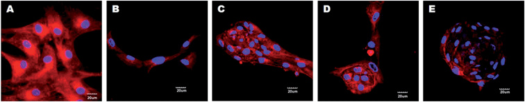 Confocal microscopy images (merged) for AFP expression (Alexa Fluor 594: red colour) during hepatosphere formation on PLACL/collagen nanofibrous scaffolds on day 14 (A), day 18 (B), day 21 (C), day 24 (D) and day 28 (E). Nuclei were stained with DAPI (blue colour). A decline in fluorescence intensity for AFP expression was observed on hepatospheres at day 28 (scale bar = 20 μm).