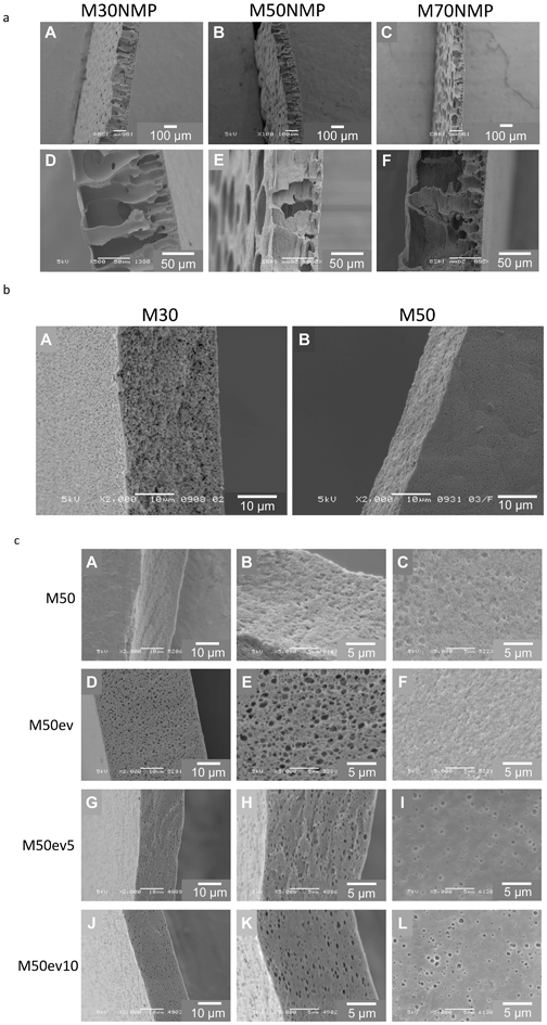Scanning electron microscopy images of SlipSkin™ based membranes. (a) Membranes M30NMP (A and D), M50NMP (B and E) and M70NMP (C and F), formed using polymer dopes of 10 wt% SlipSkin™ dissolved in NMP. (b) Membranes M30 (A) and M50 (B) formed using polymer dopes of 10 wt% SlipSkin™ dissolved in acetone. (c) Membranes formed from a 10 wt% 50 : 50 SlipSkin™ in acetone with evaporation steps of 0 seconds M50 (A, B, and C), 30 seconds M50ev (D, E, and F), 5 minutes M50ev5 (G, H, and I) and 10 minutes M50ev10 (J, K, and L) with magnifications of 2000× (A, D, G, and J) or 5000× (B, C, E, F, H, I, K, and L). Images show cross-sections (A, B, D, E, G, H, J, and K) and top surfaces (C, F, I, and L).