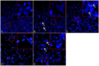 The fluorescence photomicrographs of cell apoptosis stained with Hoechst33342/PI after exposing cultured rat Sertoli cells with PCB153 for 24 h. (A) 0.3% DMSO as control, (B) 10 μmol L−1 PCB153, arrows indicate apoptotic cells, (C) 20 μmol L−1 PCB153, arrows indicate a variety of holes, (D) 30 μmol L−1 PCB153, (E) pre-treated for 1 h with 300 μmol L−1 NAC and followed by incubation with 30 μmol L−1 PCB153 for 24 h, arrows indicate cell shrinkage.