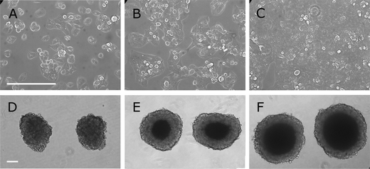 Light microscopy of C3A cells grown either in 2D or 3D conditions. A, B and C: flat culture. C3A cells were cultivated in DMEM and when they reached greater than 90% confluency, were trypsinised and sown out into microtitre plates at 10 000 cells per well. Specimens were photographed at 1, 2 and 4 days post trypsinisation corresponding to A sparse, B half-confluent and C confluent cultures. After 5 days it wound be normal to trypsinise the (confluent) culture again. The bar in A indicates 200 μm. D, E and F: spheroid culture. C3A cells were cultivated in DMEM, trypsinised and sown out into AggreWell™ plates for centrifugation. The pellets were then left for 24 h for the cells to bond and then released into suspension culture as spheroids. These spheroids were then cultured in suspension in a rotating bioreactor. Spheroids were photographed at 3, 6 and 17 days respectively after establishing the culture. D Three days after introduction of spheroids into the bioreactor the cells are still loose and can be easily detached from spheroids. E After 6 days the cells have packed themselves more tightly (as seen by the darker centre). F After 17 days it is very difficult to observe changes by light microscopy. The bar in D indicates 200 μm.