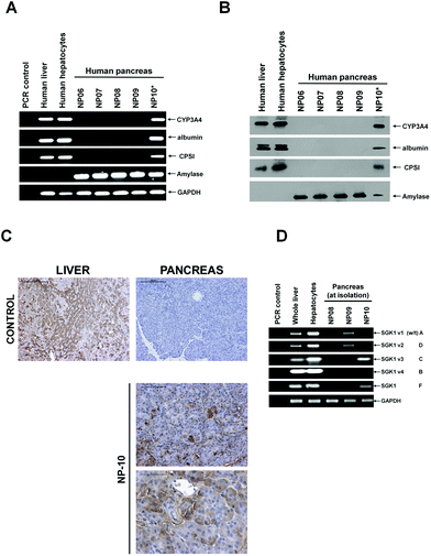 Screening human pancreas samples for the expression of hepatic markers. A, RT-PCR for the indicated transcript. PCR control, amplification in the absence of RNA in the 1st strand cDNA synthesis step. B, Western blot for the indicated protein. C, Immunohistochemical staining for CYP3A4 in sections from control human liver and pancreas and in pancreas sections from NP10, no primary control – identical staining without primary antibody incubation.